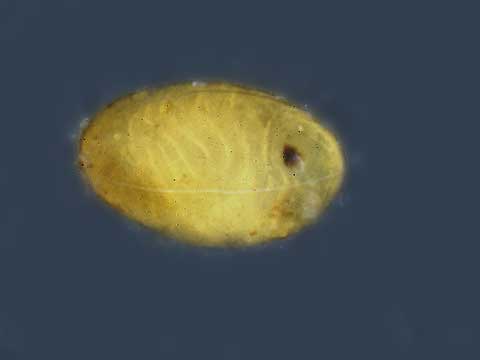 シオカラトンボの孵化直前の卵